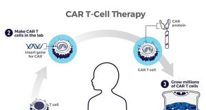 Engineered CAR T cell delivery Car T Cell Infusion Therapy