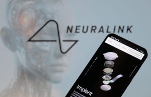 Neuralink Unveils $158M Brain Implant Sewing Device Microscopic view of ultra-thin threads being inserted into brain tissue by a robotic sewing device in a lab setting.